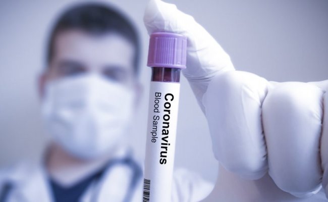 Дизайнер Заболотный о коронавирусе: Сказали - отвезут в больницу, где точно заразят COVID-19, или тихо сидеть дома