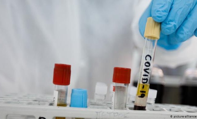Число заболевших COVID-2019 в Беларуси приближается к 60-ти тысячам
