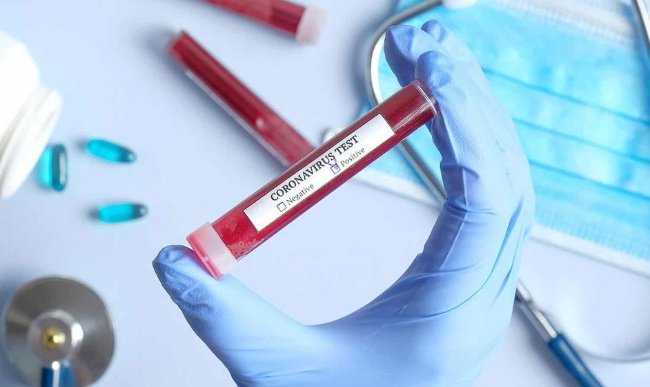 В Беларуси зарегистрировано почти 65 тысяч случаев заражения коронавирусом
