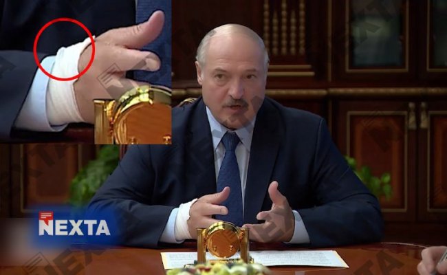 Телеграм-канал: Лукашенко проводил совещание с катетром в руке
