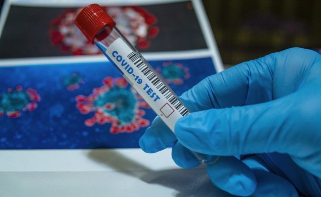 Более 68 тысяч случаев заболевания коронавирусом подтвердили в Минздраве Беларуси