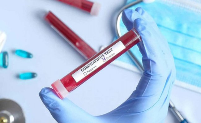 Минздрав Беларуси зарегистрировал за сутки 99 случаев заболевания коронавирусом