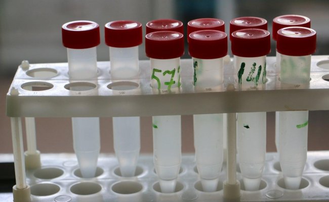 Минздрав зарегистрировал более 93 с половиной тысяч случаев заражения коронавирусом