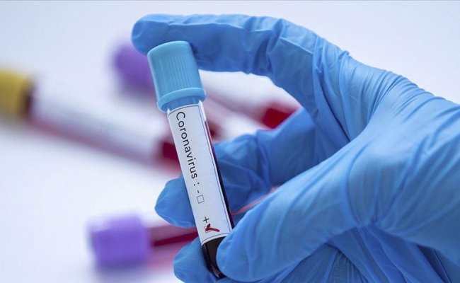 Более 1700 случаев заражения коронавирусом зарегистрировали в Беларуси за сутки