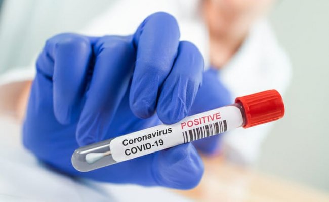 Минздрав Беларуси снова констатировал суточный рост заболеваний коронавирусом