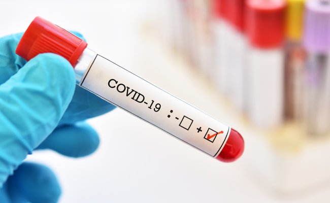 Минздрав снова зафиксировал почти 2 тысячи заражений коронавирусом