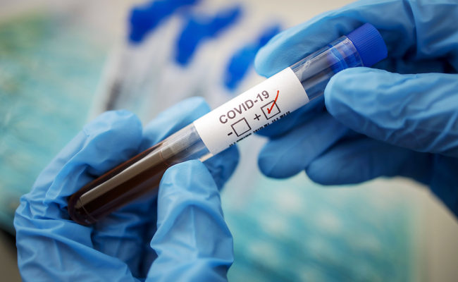 В Беларуси количество зараженных коронавирусом превысило 575 тысяч