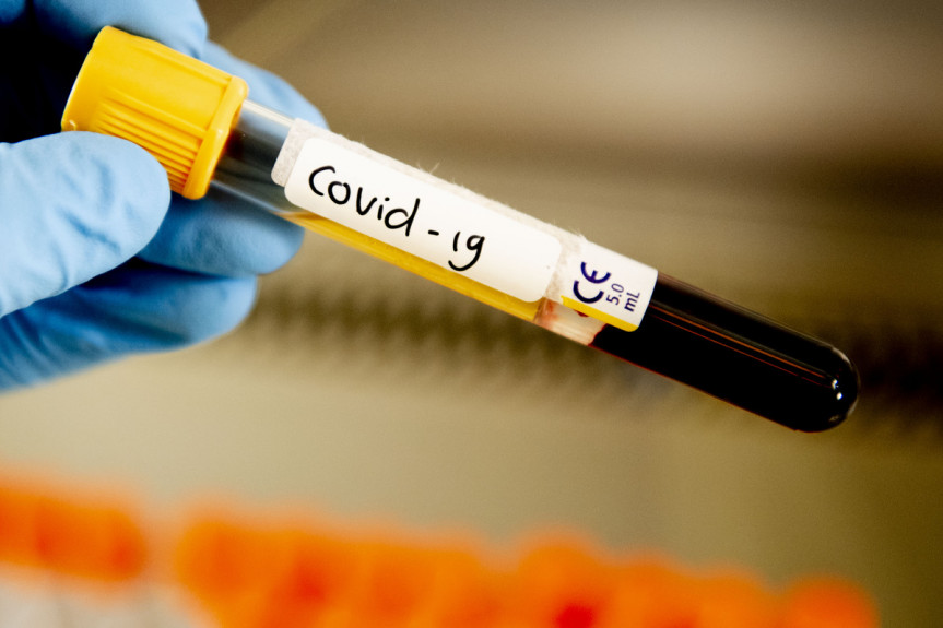 И снова рост: Минздрав обновил данные по заболеваемости коронавирусом